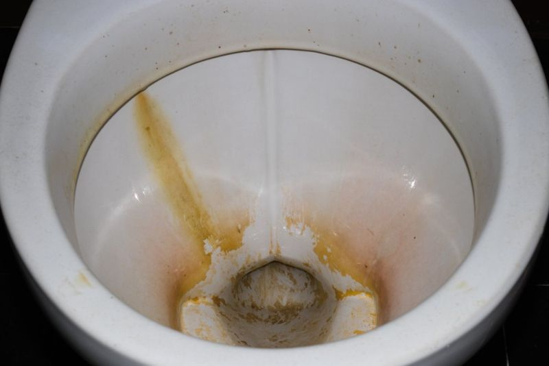 Hvad forårsager urinbelægning på et toilet? (Find ud af det nu!)